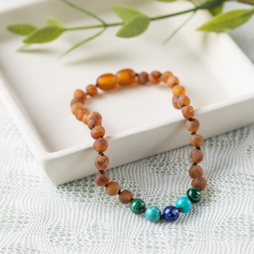 Adults | Malachite Mix + Raw Cognac Amber Anklet - R.B. Amber Jewelry