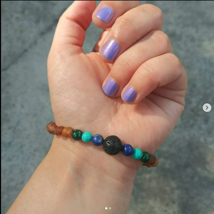 Adults | Malachite Mix + Raw Cognac Aromatherapy Bracelet - R.B. Amber Jewelry