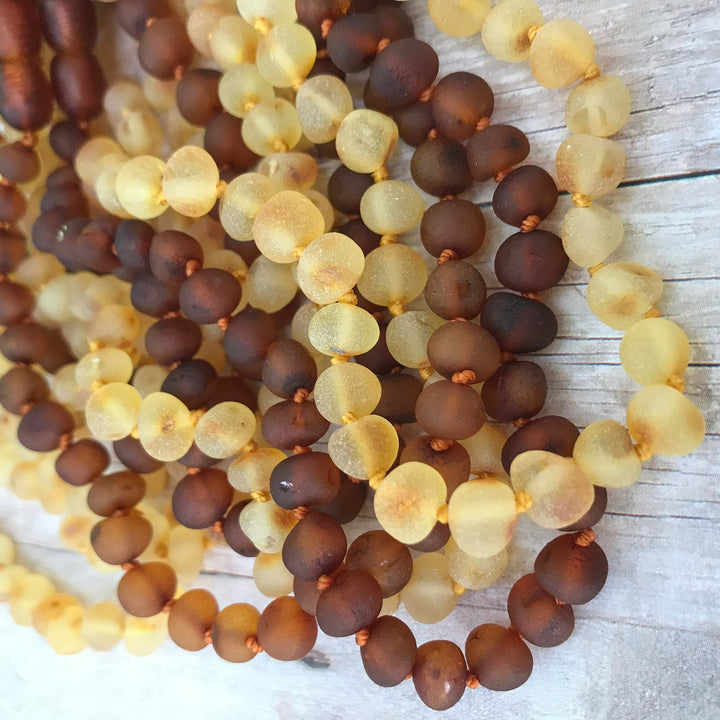 Adults | Raw Honey Baltic Amber Necklace